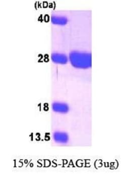 Novus Biologicals&trade;&nbsp;Recombinant Human Surf1 His Protein