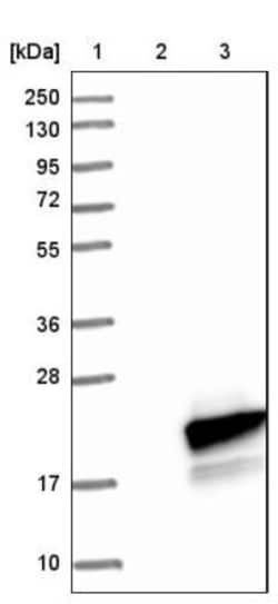 SURF5 Antibody, Novus Biologicals 25 &mu;L; Unlabeled:Antibodies, Polyclonal