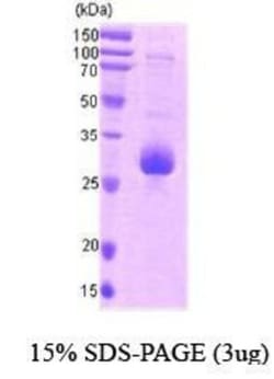 Novus Biologicals&trade;&nbsp;Recombinant Human Survivin Calmodulin Protein
