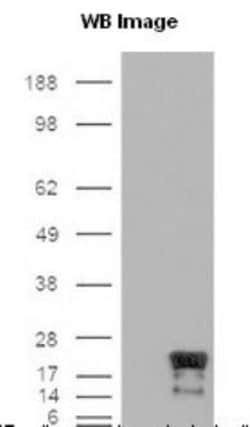 Survivin Antibody (60.11) - BSA Free, Novus Biologicals 0.1mL; Unlabeled:Antibodies,
