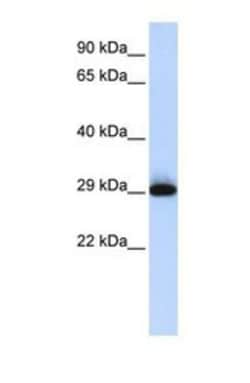 SUSD3 Antibody, Novus Biologicals 0.05mg; Unlabeled:Antibodies, Polyclonal