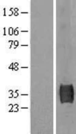 Novus Biologicals&trade;&nbsp;SUSD3 Overexpression Lysate