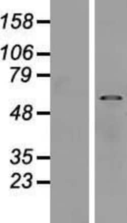 Novus Biologicals&trade;&nbsp;SUSD4 Overexpression Lysate