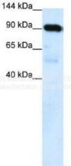 SUV420h1 Antibody, Novus Biologicals 0.05mg; Unlabeled:Antibodies, Polyclonal