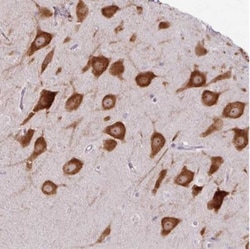 SUV420H2 Antibody, Novus Biologicals:Antibodies:Primary Antibodies