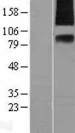 Novus Biologicals&trade;&nbsp;SV2A Overexpression Lysate