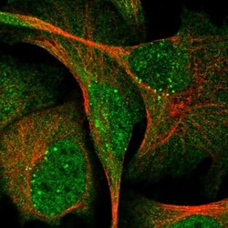 SVIP Antibody, Novus Biologicals 25 &mu;L; Unlabeled:Antibodies, Polyclonal