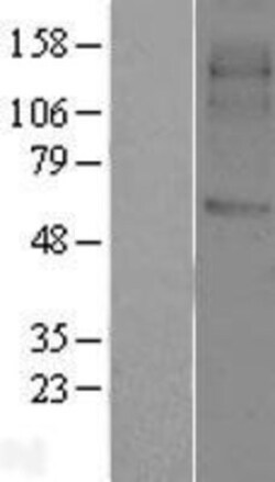 Novus Biologicals&trade;&nbsp;SVOP Overexpression Lysate
