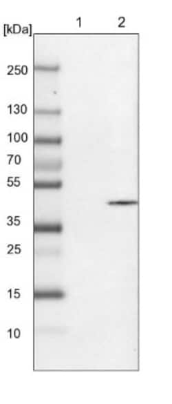 SVOPL Antibody, Novus Biologicals 0.1mL; Unlabeled:Antibodies, Polyclonal