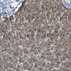 SVOPL Antibody, Novus Biologicals 0.1mL; Unlabeled:Antibodies, Polyclonal