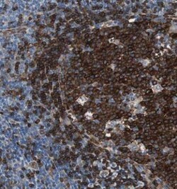 SWAP70 Antibody, Novus Biologicals 25 &mu;L; Unlabeled:Antibodies, Polyclonal