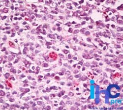 SWAP70 Antibody, Novus Biologicals 0.025mg; Unlabeled:Antibodies, Polyclonal
