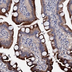 SYCE1 Antibody, Novus Biologicals 25 &mu;L; Unlabeled:Antibodies, Polyclonal