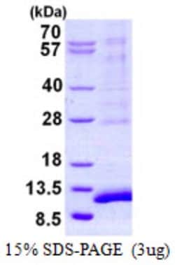 Novus Biologicals&trade;&nbsp;Recombinant Human SYCE3 His Protein