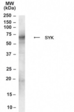 SYK Antibody, Novus Biologicals 0.1mg; Unlabeled:Antibodies, Polyclonal