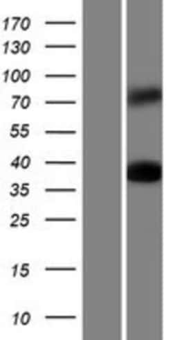Novus Biologicals&trade;&nbsp;Synapsin I Overexpression Lysate