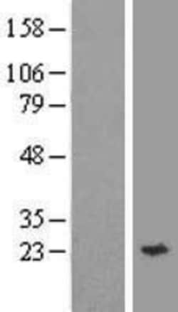 Novus Biologicals™ Synaptobrevin homolog YKT6 Overexpression Lysate
