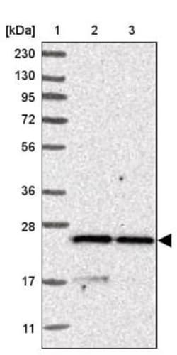 Synaptobrevin homolog YKT6 Antibody, Novus Biologicals 0.1mL; Unlabeled:Antibodies,