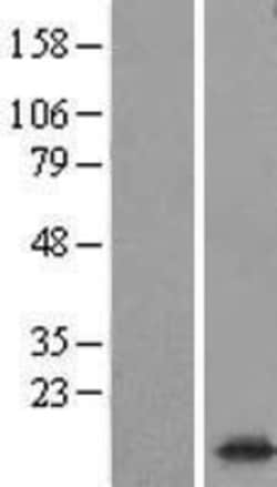 Novus Biologicals™ Synaptogyrin 1 Overexpression Lysate