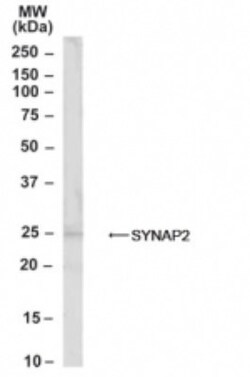 Synaptogyrin 2 Antibody, Novus Biologicals 0.1mg; Unlabeled:Antibodies,