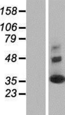 Novus Biologicals™ Synaptogyrin 2 Overexpression Lysate