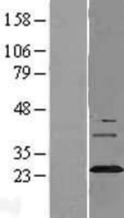 Novus Biologicals&trade;&nbsp;Synaptogyrin 3 Overexpression Lysate