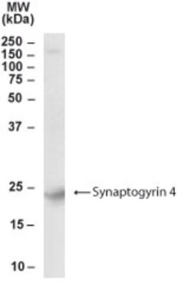 Synaptogyrin 4 Antibody, Novus Biologicals 0.1mg; Unlabeled:Antibodies,