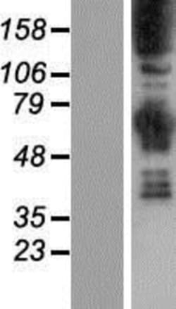 Novus Biologicals&trade;&nbsp;Synaptojanin 1 Overexpression Lysate
