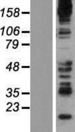 Novus Biologicals™ Synaptojanin 2 Overexpression Lysate