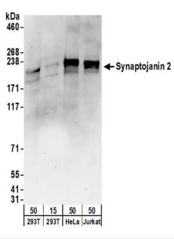 Synaptojanin 2 Antibody, Novus Biologicals 0.1mg; Unlabeled:Antibodies,