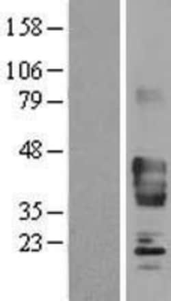 Novus Biologicals&trade;&nbsp;Synaptophysin Overexpression Lysate