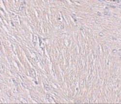 Synaptopodin Antibody - BSA Free, Novus Biologicals 0.1mg; Unlabeled:Antibodies,