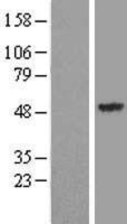 Novus Biologicals&trade;&nbsp;Synaptotagmin 13 Overexpression Lysate