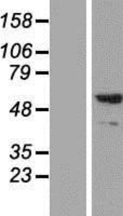 Novus Biologicals™ Synaptotagmin 2 Overexpression Lysate