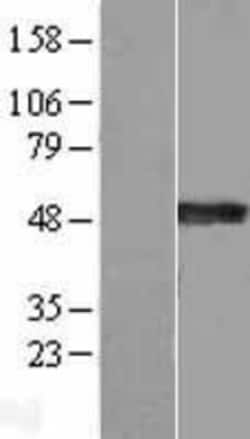 Novus Biologicals&trade;&nbsp;Synaptotagmin 4 Overexpression Lysate