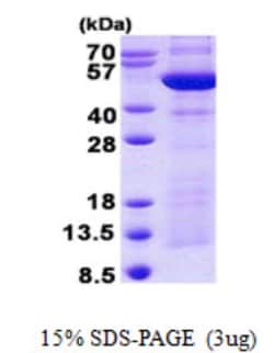 Novus Biologicals&trade;&nbsp;Recombinant Human Synaptotagmin 4 His Protein