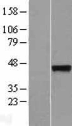 Novus Biologicals&trade;&nbsp;Synaptotagmin 5 Overexpression Lysate