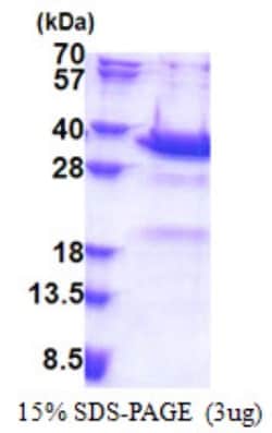 Novus Biologicals&trade;&nbsp;Recombinant Human Synaptotagmin 5 His Protein