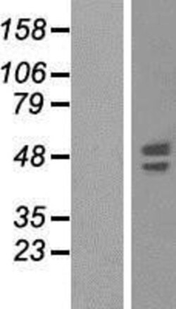 Novus Biologicals&trade;&nbsp;Synaptotagmin 6 Overexpression Lysate