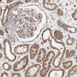 PYGL Antibody, Novus Biologicals:Antibodies:Primary Antibodies