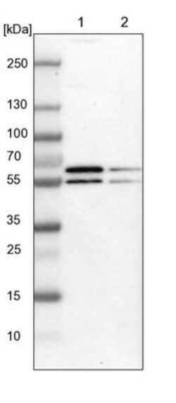 PYGL Antibody, Novus Biologicals:Antibodies:Primary Antibodies