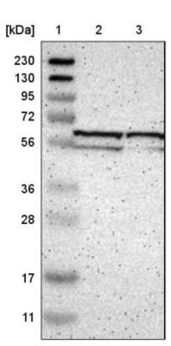PYGL Antibody, Novus Biologicals:Antibodies:Primary Antibodies