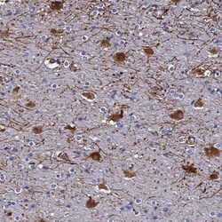 Synaptotagmin 13 Antibody, Novus Biologicals:Antibodies:Primary Antibodies
