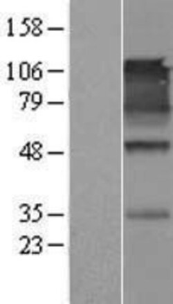 Novus Biologicals&trade;&nbsp;IGSF4A/SynCAM1/CADM1 Overexpression Lysate