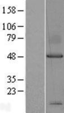 Novus Biologicals&trade;&nbsp;Syndecan-1/CD138 Overexpression Lysate
