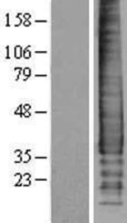 Novus Biologicals&trade;&nbsp;Syndecan-2/CD362 Overexpression Lysate