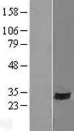 Novus Biologicals&trade;&nbsp;SYNDIG1 Overexpression Lysate