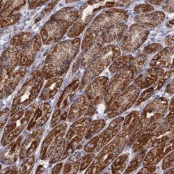SYNJ2BP/ARIP2 Antibody, Novus Biologicals 25 &mu;L | Buy Online | Novus Biologicals | Fisher Scientific