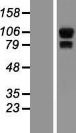 Novus Biologicals&trade;&nbsp;Synphilin-1 Overexpression Lysate