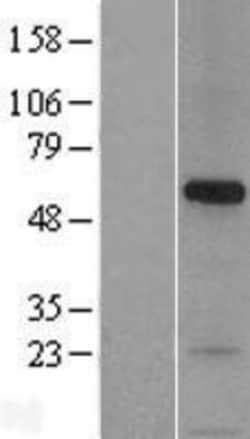 Novus Biologicals&trade;&nbsp;Syntaphilin Overexpression Lysate